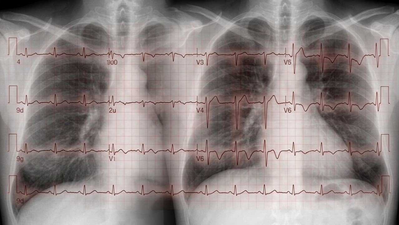 Medical exams in the age of AI